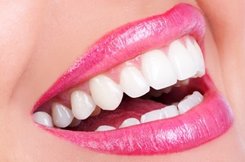 close-up of patient’s smile after teeth whitening